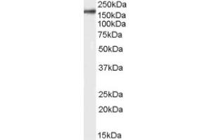 Image no. 1 for anti-Integrin alpha M (ITGAM) (Internal Region) antibody (ABIN374760) (CD11b anticorps  (Internal Region))