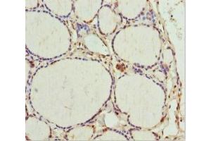 Immunohistochemistry of paraffin-embedded human thyroid tissue using ABIN7172703 at dilution of 1:100
