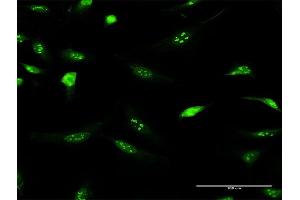 Immunofluorescence of purified MaxPab antibody to IFRD2 on HeLa cell.