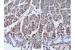 Immunohistochemistry of paraffin-embedded human stomach using SFRP1 antibody (ABIN1682675, ABIN1682676, ABIN5664178 and ABIN6219906) at dilution of 1:50 (20x lens). (SFRP1 anticorps  (AA 30-314))