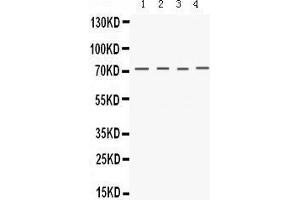 Western Blotting (WB) image for anti-Potassium Voltage-Gated Channel, Shaker-Related Subfamily, Member 4 (KCNA4) (AA 609-647), (C-Term) antibody (ABIN3043264) (Kv1.4 anticorps  (C-Term))