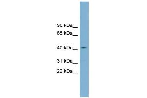 WB Suggested Anti-ZDHHC18 Antibody Titration:  0.