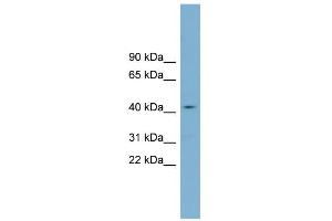 WB Suggested Anti-ZDHHC18 Antibody Titration:  0. (ZDHHC18 anticorps  (Middle Region))