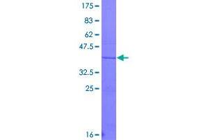 Image no. 1 for Proteoglycan 4 (PRG4) (AA 1305-1404) protein (GST tag) (ABIN1316188)