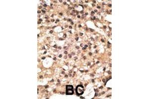 anti-Autophagy related 4B Cysteine Peptidase (ATG4B) (AA 16-45), (N-Term) antibody
