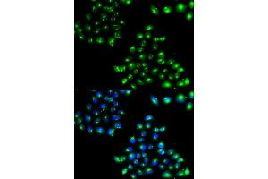 Immunofluorescence analysis of U20S cell using COPB2 antibody. (COPB2 anticorps)