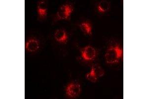 Immunofluorescent analysis of PiT2 staining in Hela cells. (SLC20A2 anticorps)