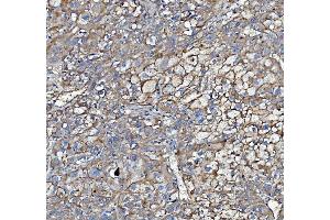 IHC analysis of Poliovirus Receptor/PVR using anti-Poliovirus Receptor/PVR antibody (ABIN7601069). (Poliovirus Receptor anticorps  (AA 28-331))