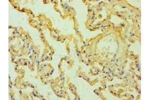 Immunohistochemistry of paraffin-embedded human lung tissue using ABIN7159426 at dilution of 1:100