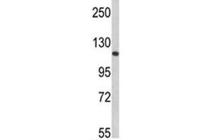 Western blot analysis of Retinoblastoma antibody and 293 lysate (Retinoblastoma Protein (Rb) anticorps  (AA 858-886))