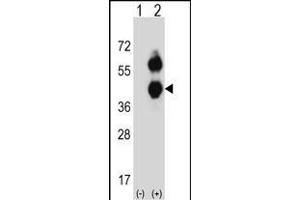 Western blot analysis of BCAT2 (arrow) using rabbit polyclonal BCAT2 Antibody (C-term) (ABIN656822 and ABIN2846033).