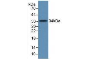 Western blot analysis of recombinant Human C5a. (C5A anticorps  (AA 678-751))