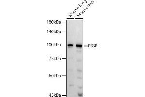 Western blot analysis of extracts of various cell lines, using PIGR antibody (ABIN6128562, ABIN6145618, ABIN6145620 and ABIN6221728) at 1:1000 dilution. (PIGR anticorps  (AA 661-764))