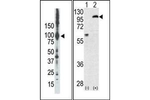 (LEFT)Western blot analysis of anti-PKCepsilon Pab in placenta lysate. (PKC epsilon anticorps  (N-Term))