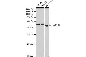 Western blot analysis of extracts of various cell lines, using B antibody (ABIN7265767) at 1:1000 dilution. (ATP4b anticorps)