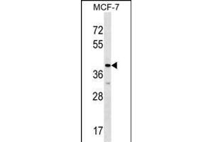 MRPL1 Antibody (N-term) (ABIN1539553 and ABIN2848606) western blot analysis in MCF-7 cell line lysates (35 μg/lane). (MRPL1 anticorps  (N-Term))