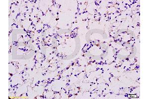 Formalin-fixed and paraffin embedded rat lung tissue labeled with Anti-EPOR Polyclonal Antibody (ABIN686347), Unconjugated at 1:200 followed by conjugation to the secondary antibody and DAB staining (EPOR anticorps  (AA 301-450))
