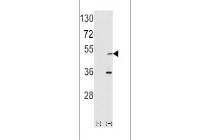 Western blot analysis of AIK using rabbit polyclonal hAIK-H105 using 293 cell lysates (2 ug/lane) either nontransfected (Lane 1) or transiently transfected with the AIK gene (Lane 2).