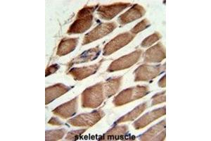 Immunohistochemistry (IHC) image for anti-ARP3 Actin-Related Protein 3 (ACTR3) antibody (ABIN3001697) (ACTR3 anticorps)