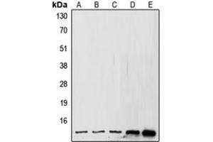 Western blot analysis of SUMO1 expression in MCF7 (A), A431 (B), HeLa (C), mouse kidney (D), rat kidney (E) whole cell lysates. (SUMO1 anticorps  (N-Term))