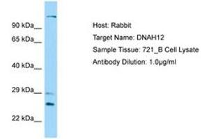 Image no. 1 for anti-Dynein, Axonemal, Heavy Chain 12 (DNAH12) (AA 91-140) antibody (ABIN6750179) (DNAH12 anticorps  (AA 91-140))