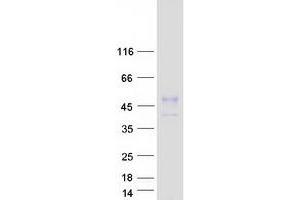 Validation with Western Blot