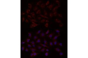Immunofluorescence analysis of PC-3 cells using NTF4 Rabbit pAb (ABIN3021387, ABIN3021388, ABIN3021389 and ABIN6214994) at dilution of 1:150 (40x lens).