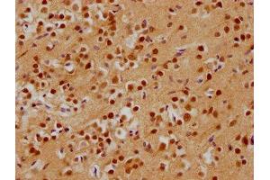 IHC image of ABIN7143183 diluted at 1:200 and staining in paraffin-embedded human brain tissue performed on a Leica BondTM system.