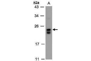 WB Image Sample(30 ug whole cell lysate) A:Raji , 12% SDS PAGE antibody diluted at 1:500 (DUSP19 anticorps)