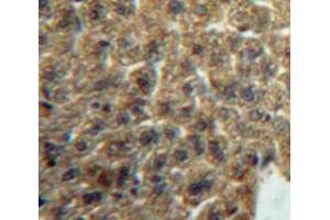 Used in DAB staining on fromalin fixed paraffin-embedded Liver tissue (Lacritin anticorps  (AA 20-138))