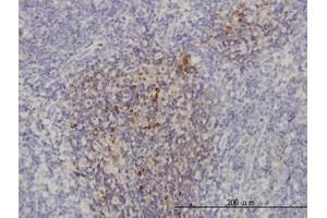 Image no. 1 for anti-Phosphoinositide-3-Kinase, Catalytic, beta Polypeptide (PIK3CB) (AA 147-257) antibody (ABIN466076) (PIK3CB anticorps  (AA 147-257))
