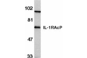 anti-Interleukin 1 Receptor Accessory Protein (IL1RAP) (C-Term) antibody