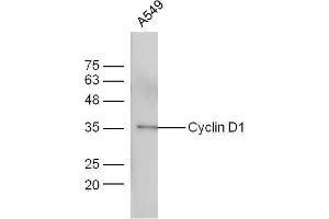 A549 cells probed with Anti-Cyclin D1 Polyclonal Antibody  at 1:5000 90min in 37˚C. (Cyclin D1 anticorps  (AA 61-110))