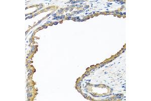 Immunohistochemistry of paraffin-embedded human prostate using NYX antibody. (Nyctalopin anticorps)