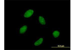 Immunofluorescence of purified MaxPab antibody to POLR3C on HeLa cell.