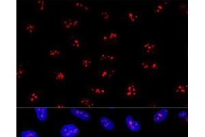 Confocal immunofluorescence analysis of U2OS cells using EBNA1BP2 Polyclonal Antibody at dilution of 1:200. (EBNA1BP2 anticorps)