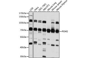 Western blot analysis of extracts of various cell lines, using PGM2 antibody (ABIN7269312) at 1:1000 dilution. (Phosphoglucomutase 2 anticorps  (AA 1-130))