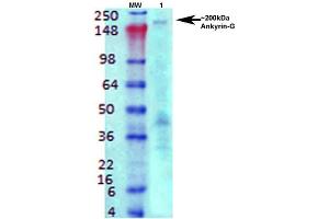 Western Blot analysis of Rat brain membrane lysate showing detection of Ankyrin G protein using Mouse Anti-Ankyrin G Monoclonal Antibody, Clone S106-20 .