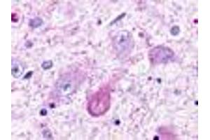 Anti-TAAR5 antibody IHC of human brain, thalamus, neurons and glia. (TAAR5 anticorps  (Cytoplasmic Domain))