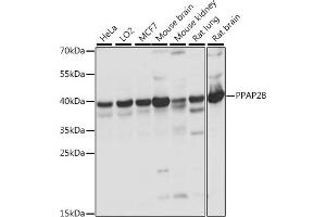 Western blot analysis of extracts of various cell lines, using PPB antibody (ABIN7269278) at 1:1000 dilution.