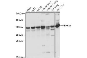 Western blot analysis of extracts of various cell lines, using PPB antibody (ABIN7269278) at 1:1000 dilution. (PPAP2B anticorps  (AA 1-100))
