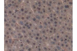 Detection of NME6 in Rat Liver Tissue using Polyclonal Antibody to Non Metastatic Cells 6, Protein Expressed In (NME6)