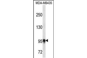 Western blot analysis in MDA-MB435 cell line lysates (35ug/lane). (PLOD3 anticorps  (N-Term))