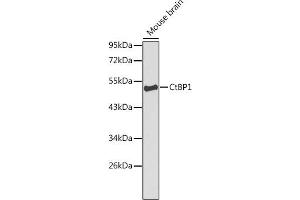 CTBP1 antibody  (AA 20-250)