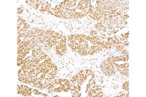 anti-Fused in Sarcoma (FUS) (AA 400-450) antibody