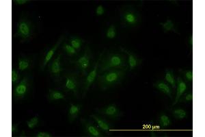 Immunofluorescence of monoclonal antibody to PCQAP on HeLa cell. (MED15 anticorps  (AA 1-88))