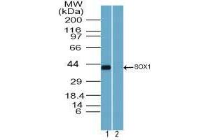 Image no. 3 for anti-SRY (Sex Determining Region Y)-Box 1 (SOX1) (AA 100-150) antibody (ABIN960348)