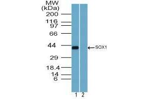 Image no. 3 for anti-SRY (Sex Determining Region Y)-Box 1 (SOX1) (AA 100-150) antibody (ABIN960348) (SOX1 anticorps  (AA 100-150))