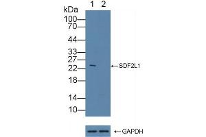 Knockout Varification: Lane 1: Wild-type BXPC3 cell lysate, Lane 2: COL3a1 knockout BXPC3 cell lysate, Predicted MW: 111,138kd Observed MW: 110kd Primary Ab: 1 μg/mL Rabbit Anti-Human COL3a1 Antibody Second Ab: 0.