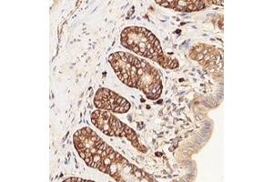 Immunohistochemistry analysis of paraffin-embedded rat rectum using,RPL10 (ABIN7075428) at dilution of 1: 4000